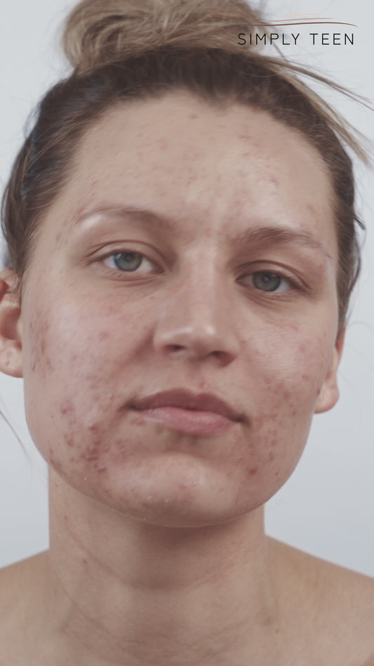 3 Times A Charm – Serum